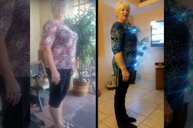 Kathie's Success Story - "The Belly Fat Melted Away"