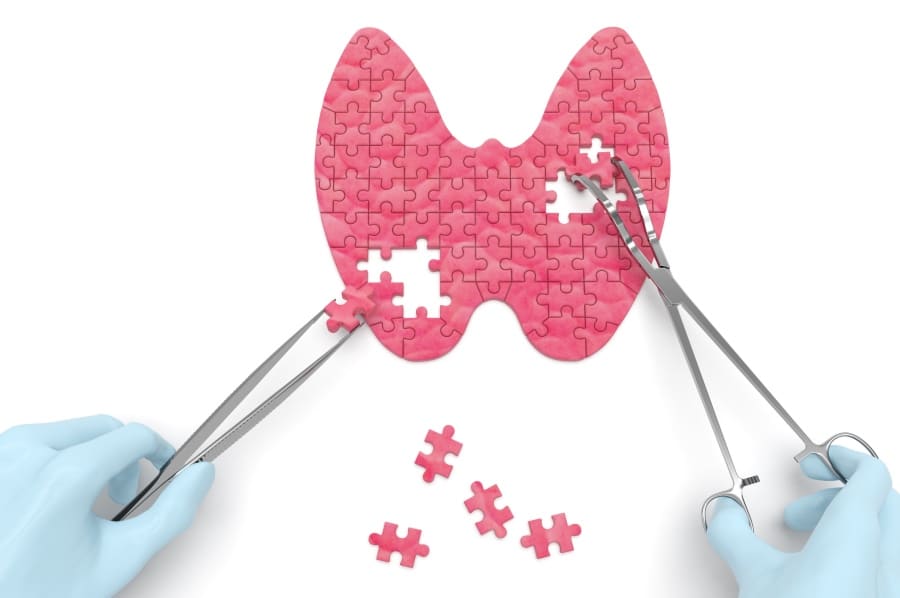 Doctor putting together puzzle pieces of thyroid for losing weight because of thyroid problems