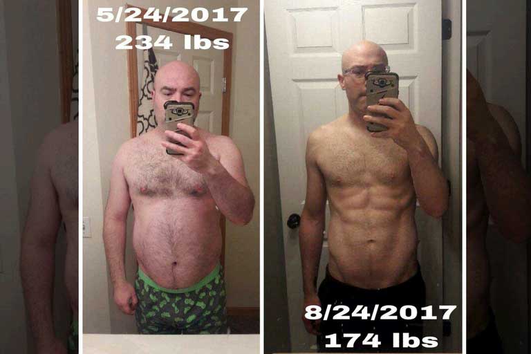 Historia de éxito de Ben - reflujo ácido y pérdida de peso
