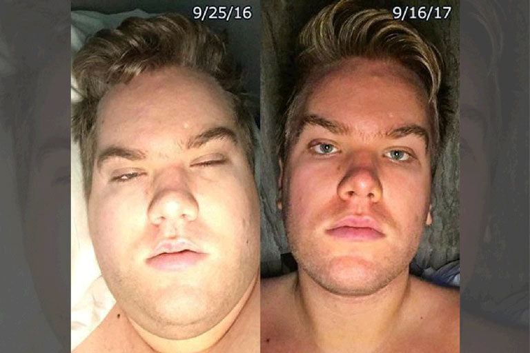 Brock's Bone Broth Diet Success Story - Auto-Immune Healing and 90lb Weight Loss