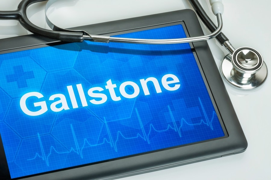 A tablet with the word Gallstone on the screen